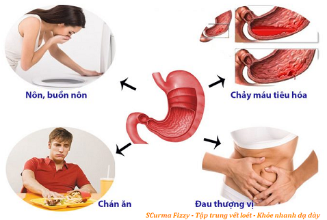 Điểm mặt các dấu hiệu bất thường về đau dạ dày cần tới bác sĩ