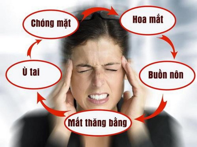 Rối loạn tiền đình: Những điều cần biết và cách phòng tránh